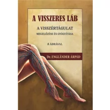   A visszeres láb a visszértágulat megelőzése és gyógyítása